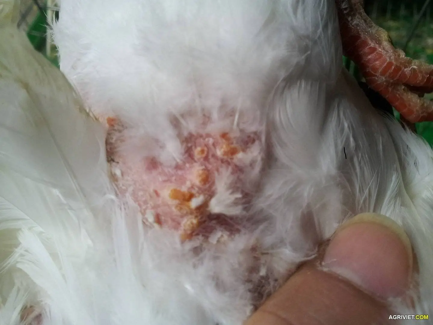 Bệnh bồ câu pháp