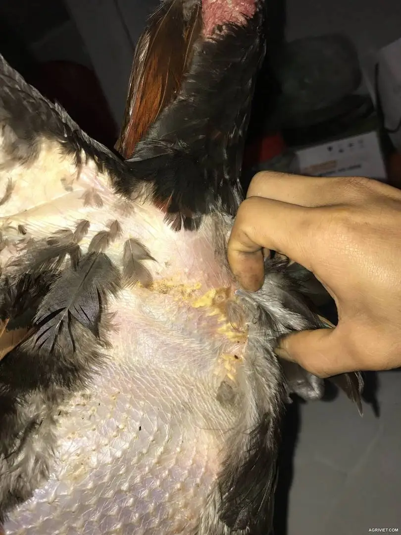 Gà bị zona giống như ở người