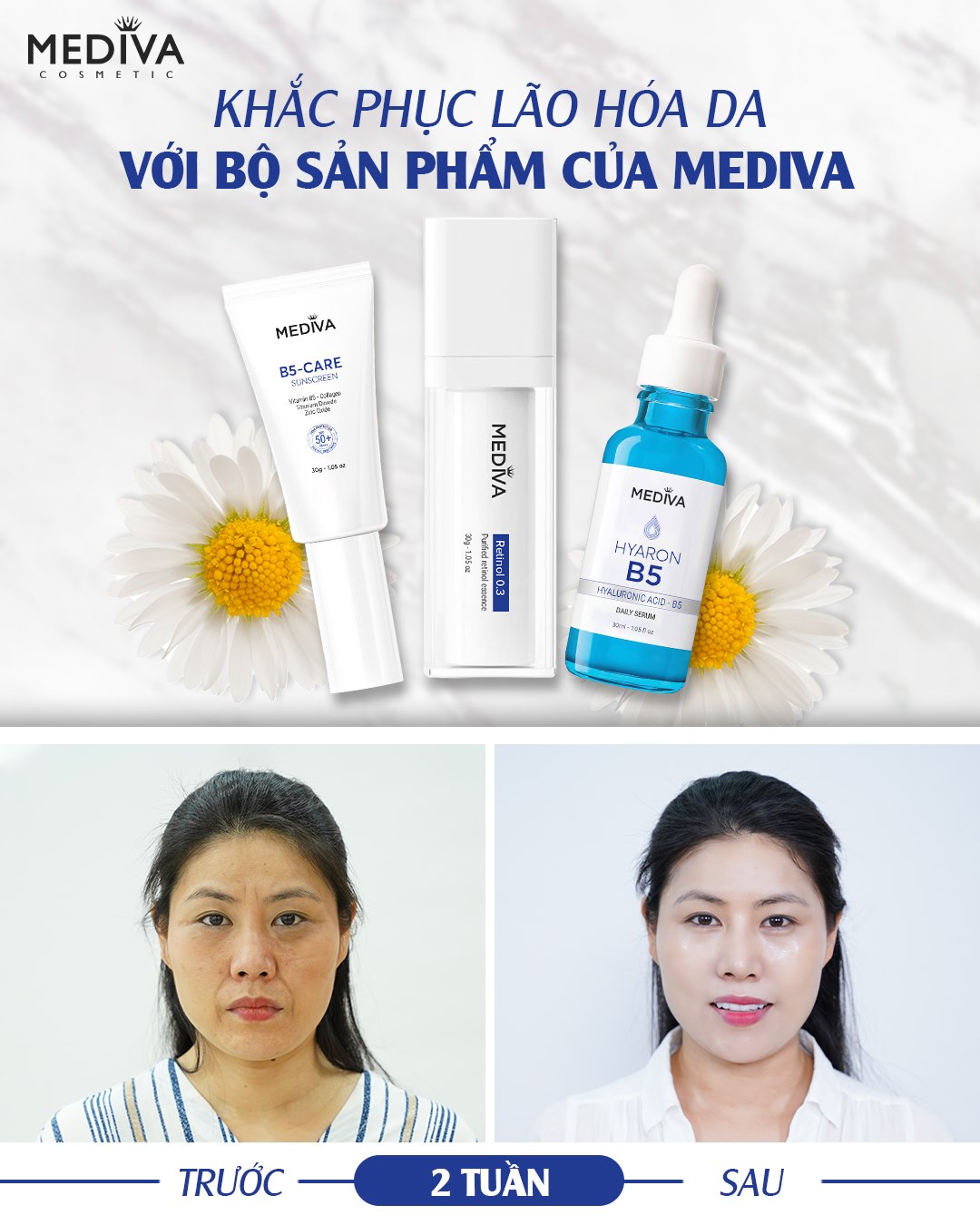 Khắc phục lão hóa da với bộ 3 siêu phẩm Mediva Retinol Rejuvenating Combo